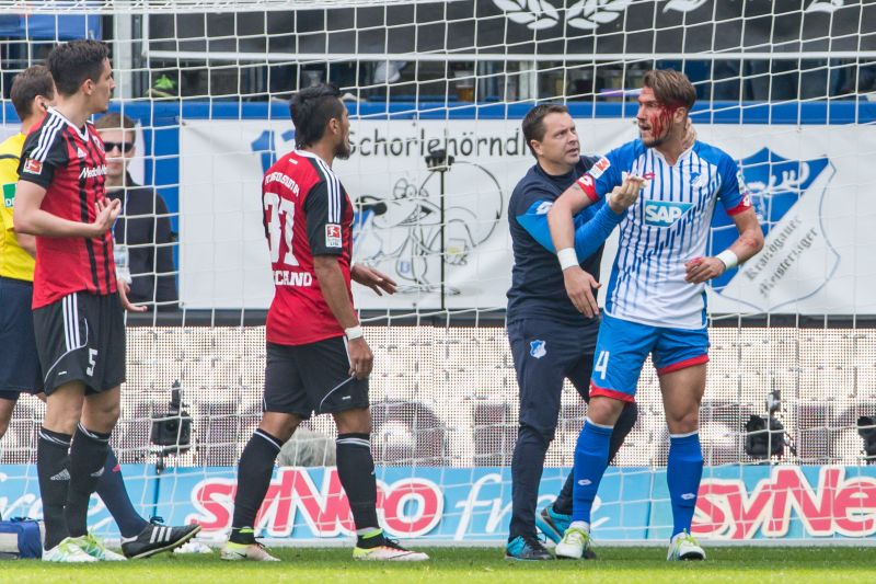 Die klaffende Platzwunde bei Ermin Bicakcic ...