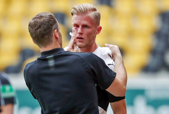 Beim Auswärtsspiel in Dresden erlitt Seegert einen schmerzhaften Augenhöhlenbruch